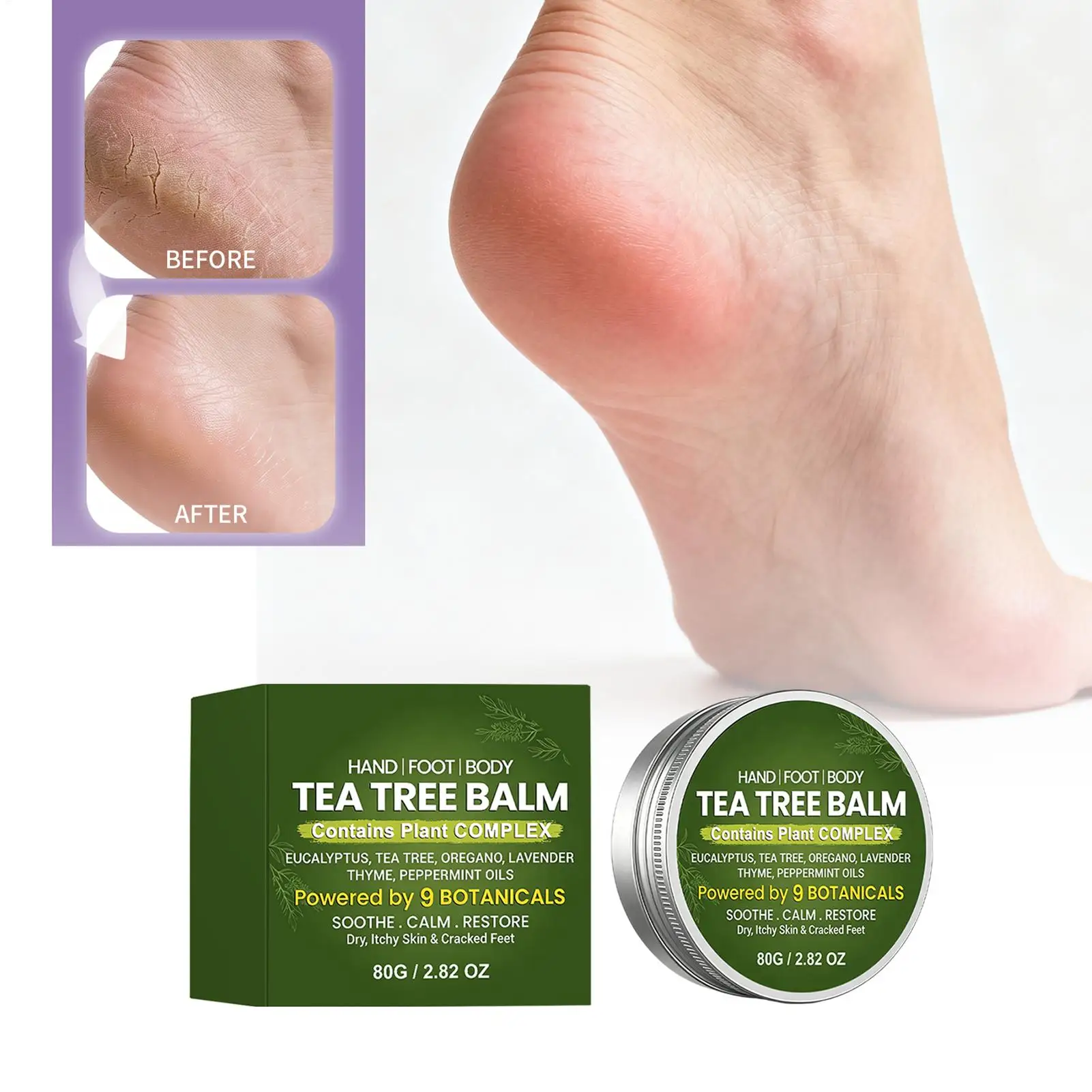 anti itching cream Tea tree oil soothing foot cream Relieves itchy skin Gentle moisturizing cream 80g  Hydrating Foot Balm