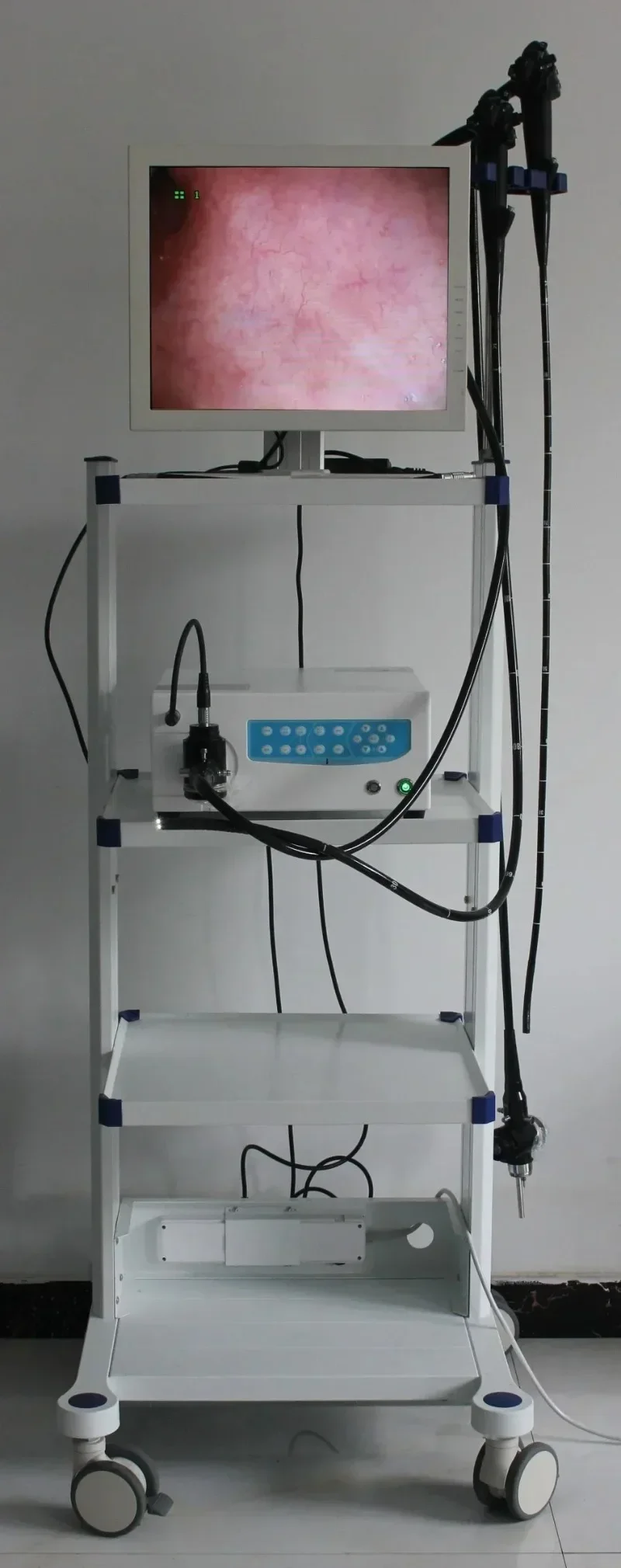 رائجة البيع المنظار Draagbare فيديو منظار القولون منظار المعدة البيطري Endoscoop Prijs