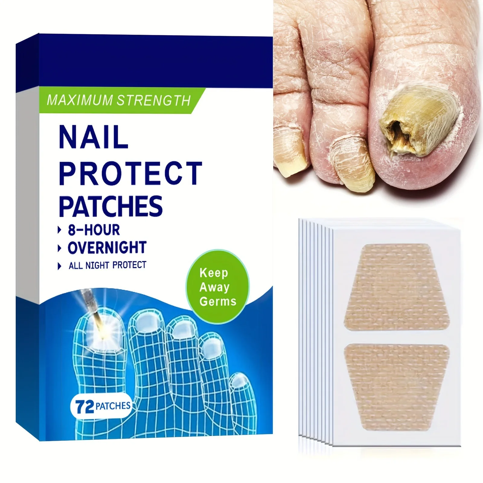 72pcs Nail Repair Treatment Patch Thickening Soft Paronychia Anti Infection Nail Repair Patch Nail Correction Stickers Foot Care