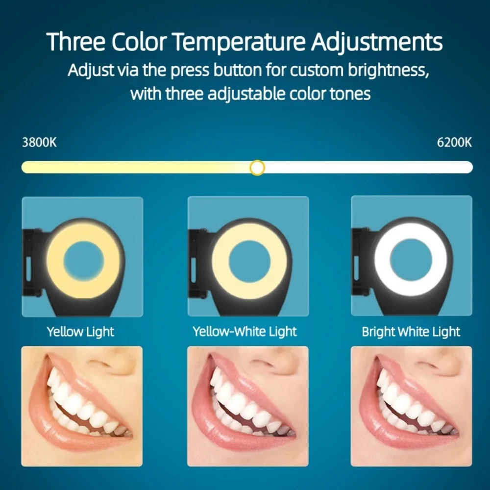 Dental Photography Ring Light Adjustable Brightness Warm/White with Tripod Dentistry Oral Photography Filling Lamp Equipment