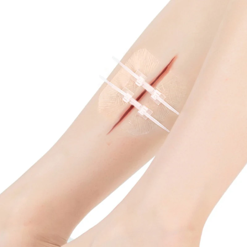 New Emergency Wound Closure Zip  Sutures Bandaids Repair Wounds Without Stitches For Outdoor Activities Quick Clot Wound