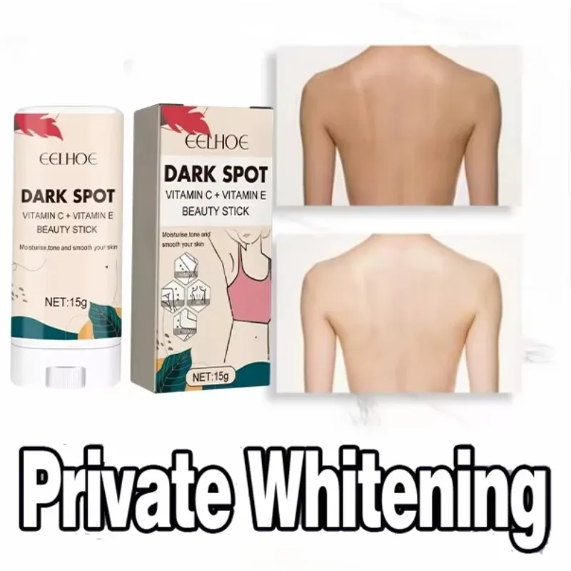 

Effective Improve Body Whitening Cream Armpit Legs Knee Elbow Bleaching Cream Dull Remove Dark Spots Melanin Brighten Skin Care