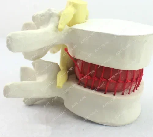 big sale! Lumbar Vertebra Slipped Disc Human Anatomical Medical Demonstration Model H#