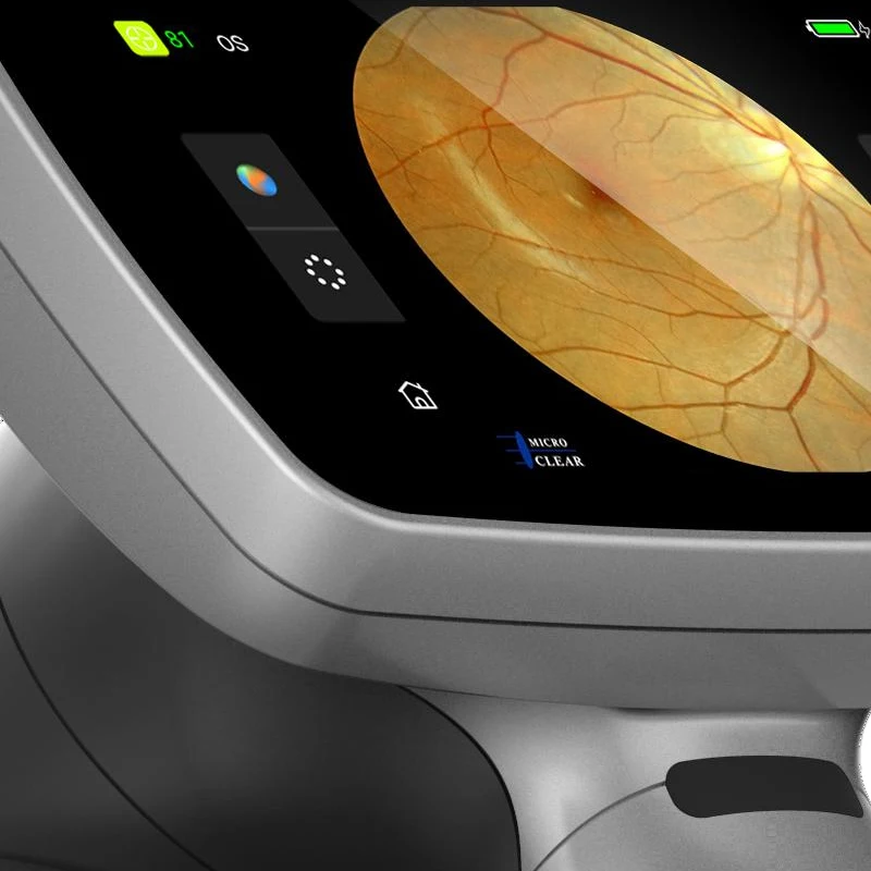 Smartfvet HSL Veterinary Instrument Ophthalmic Portable Handheld Fundus Cam Era Retina Assistant