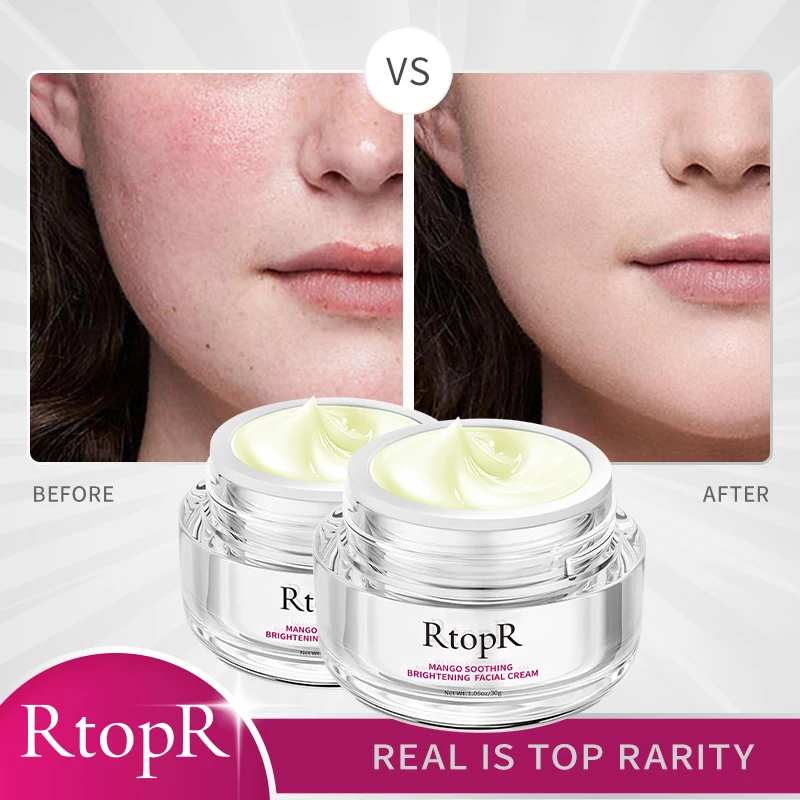 

2PCS Mango Face Anti-aging Cream Whitening Moisturize Oil Control Shrink Pores Foundation Cream Skin Care Beauty Health Women