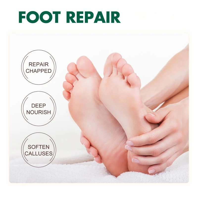 Anti Cracked Heel Treatment Cream relieve Dry itchy peeling Removal Callus Dead Skin Balm Foot Mositurizing Repair Skin Care