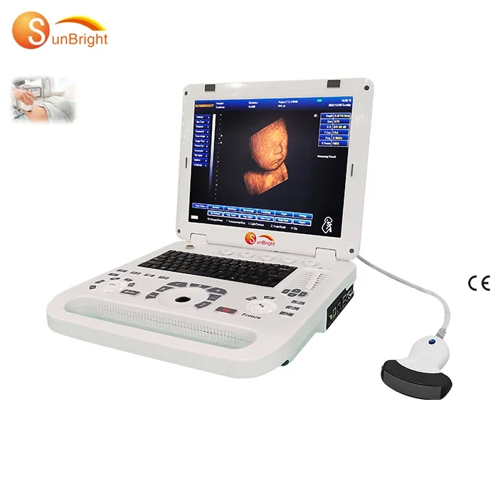 

SUN-800D Medical Ecografia port.com Портативный 2D 3D Черно-белый ультразвук