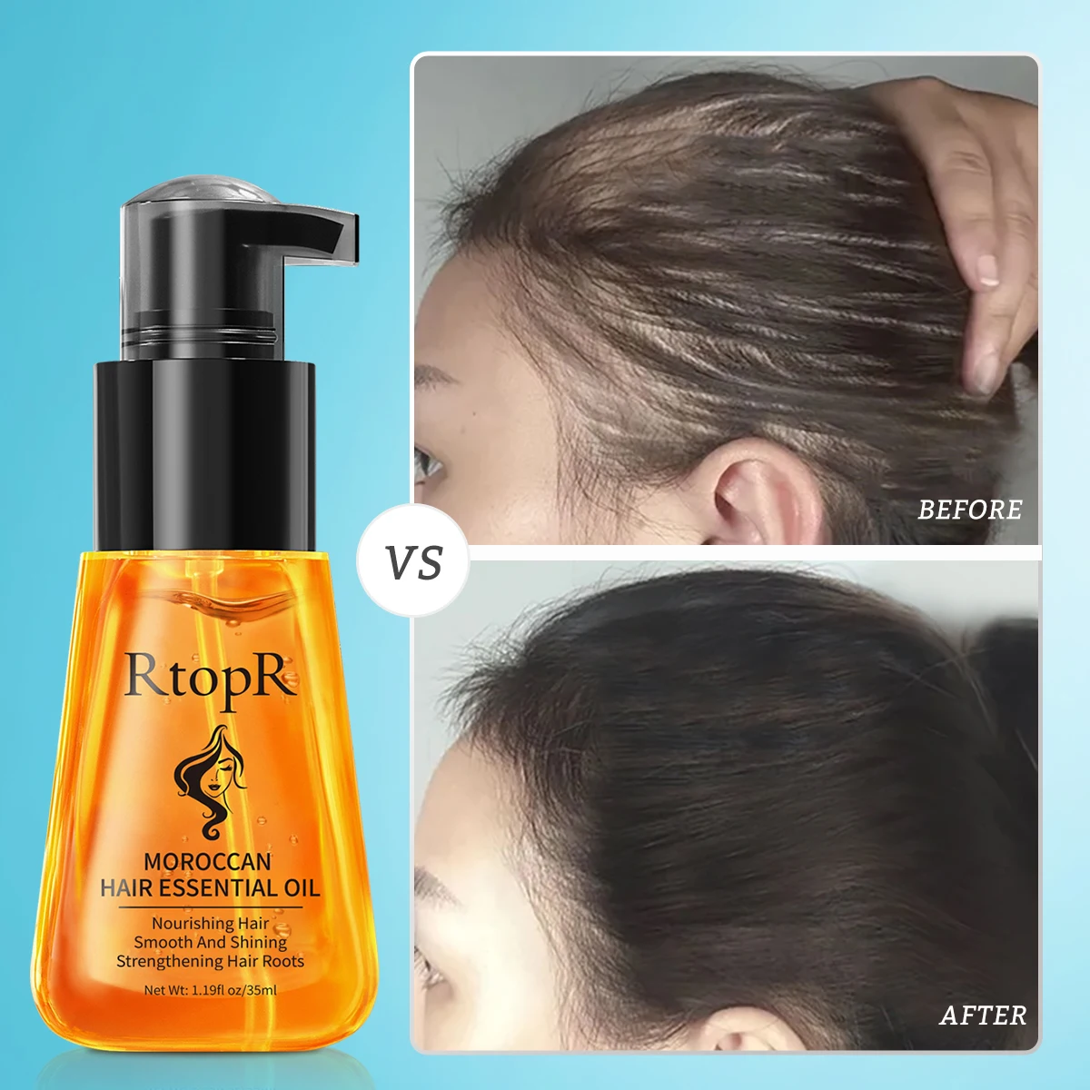 RtopR Moroccan Hair Oil Moisturizing Anti-Drying Split End Anti-Hair Loss Hair Growth Oil Gentle Unisex Relieve Itching Dandruff