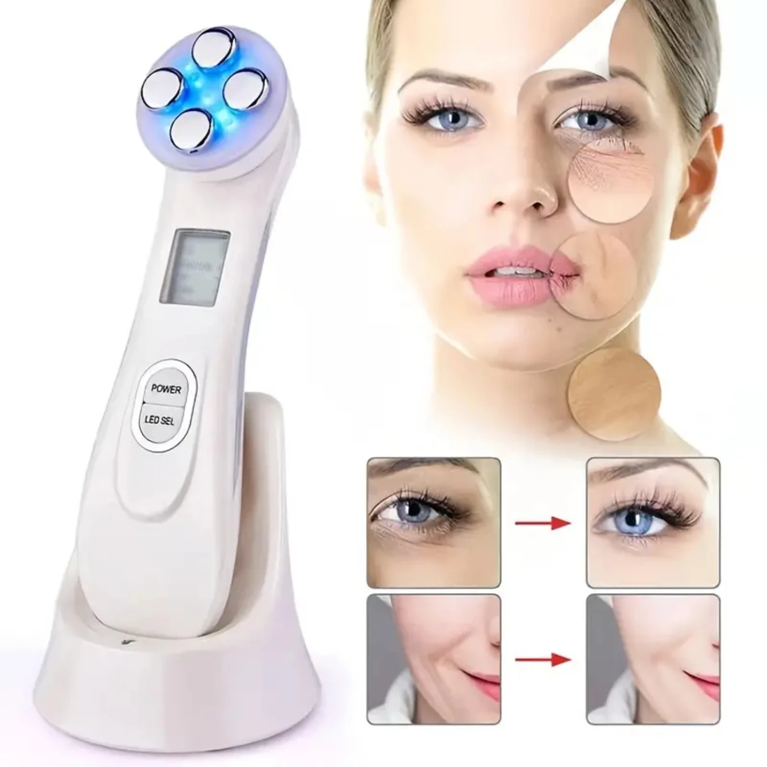 RF Beauty Device - 5 in 1 Microcurrent Facial Lifting Machine for Wrinkle and Acne Removal with Light Therapy and Radio Frequenc