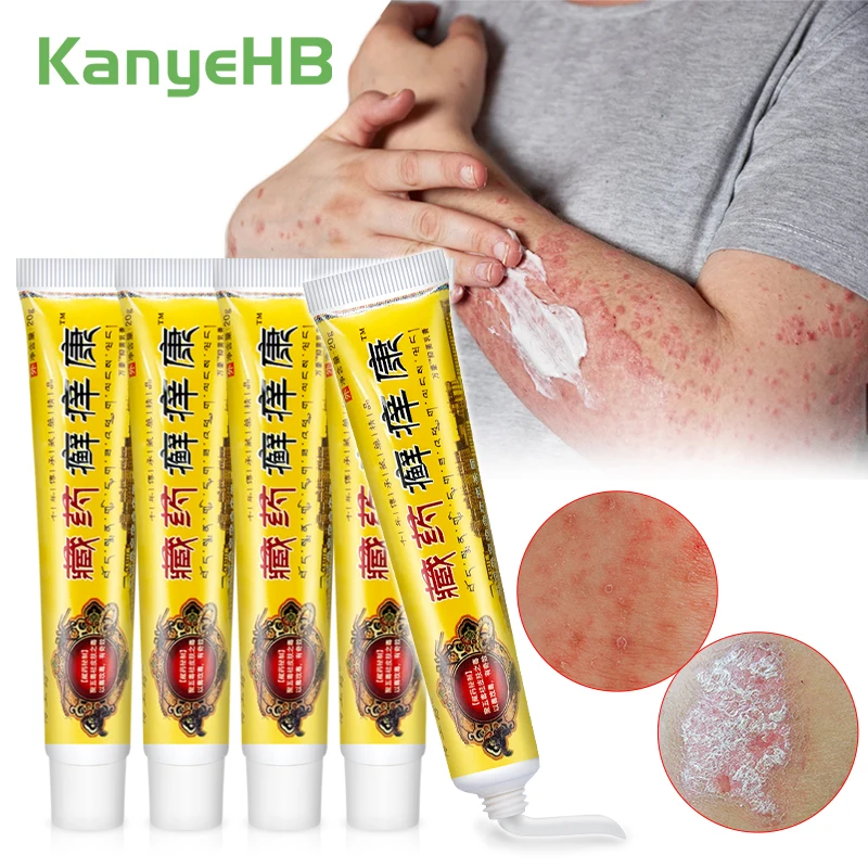 

1-3-5pcs Skin Disease Treatment Cream Chinese Medicine Psoriasis Ointment Jock Itch Tinea Pedis Papules Dermatitis Eczema Rash