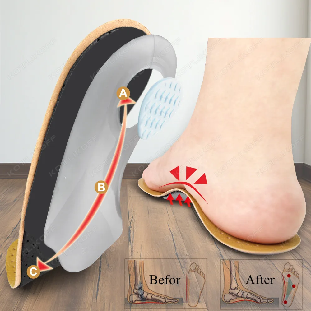 Leather Orthopedic Insoles Arch Support Insole Flat Feet Plantar Fasciitis Shoe Pad O/X Leg Corrected Comfort Deodorising Insert