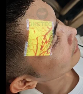 VF12 Portable Vein Finder — Easy-to-Use Handheld Vein Locator for Hands, Legs, Feet & Forehead