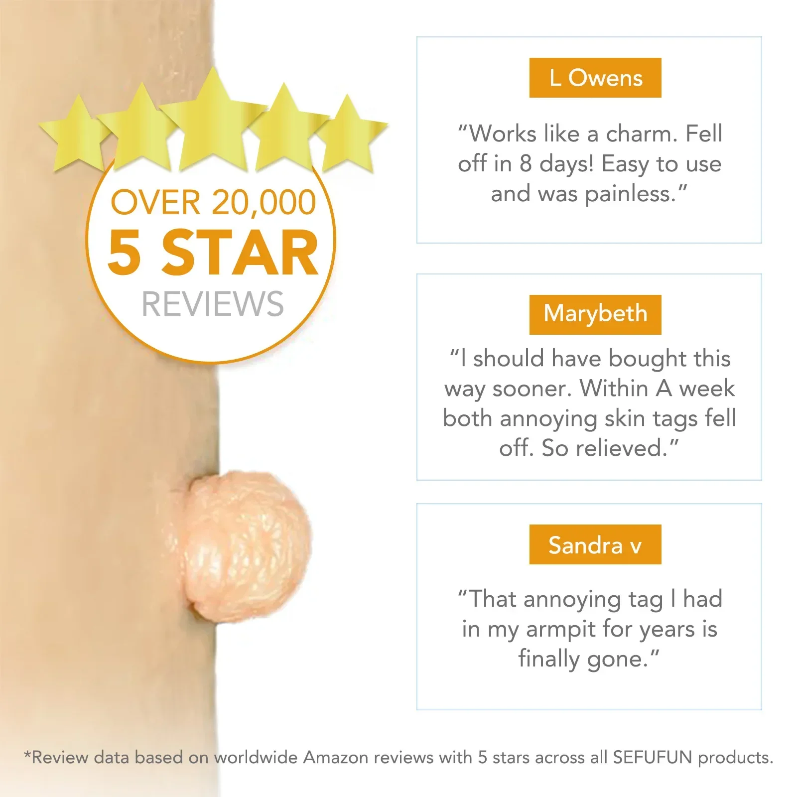 Eenvoudige gereedschapsset voor het verwijderen van wratten Huidtag Verwijderingsgereedschap Gemakkelijk schoon te maken Huidverzorgingshulpmiddel Huidtagverwijdering Verzorgingsproducten