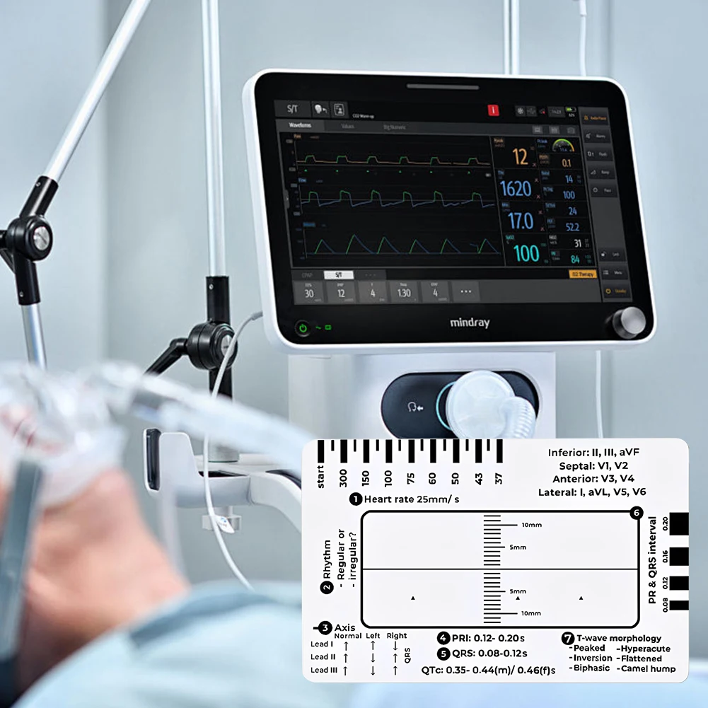 ECG 7 Step Ruler Pocket-Sized EKG Measuring Card Transparent 7 Step Ruler for ECG/EKG Interpretation