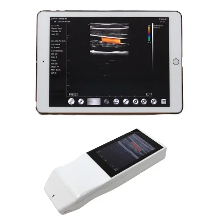 smallest integrated handheld ultrasound scanner 5G wifi high frequency probe wireless linear transdcucer