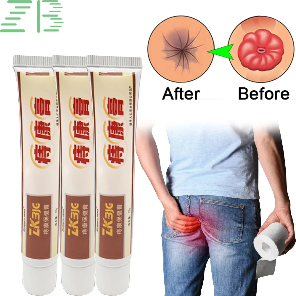 

3Pcs/Lot Chinese Medical Hemorrhoid Ointment Relieve Hemorrhoid Pain Anal Bleeding Swelling Anal Fissure Bacteriostatic Cream