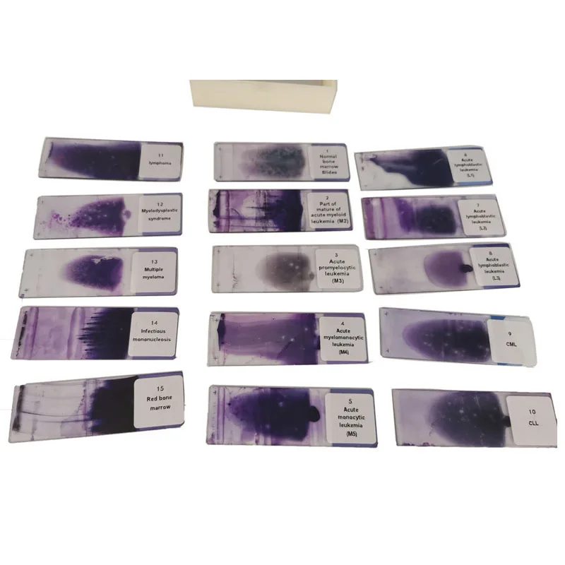 Educational School Equipment 15Pcs/Set Hematology Blood Smear Prepared Slides