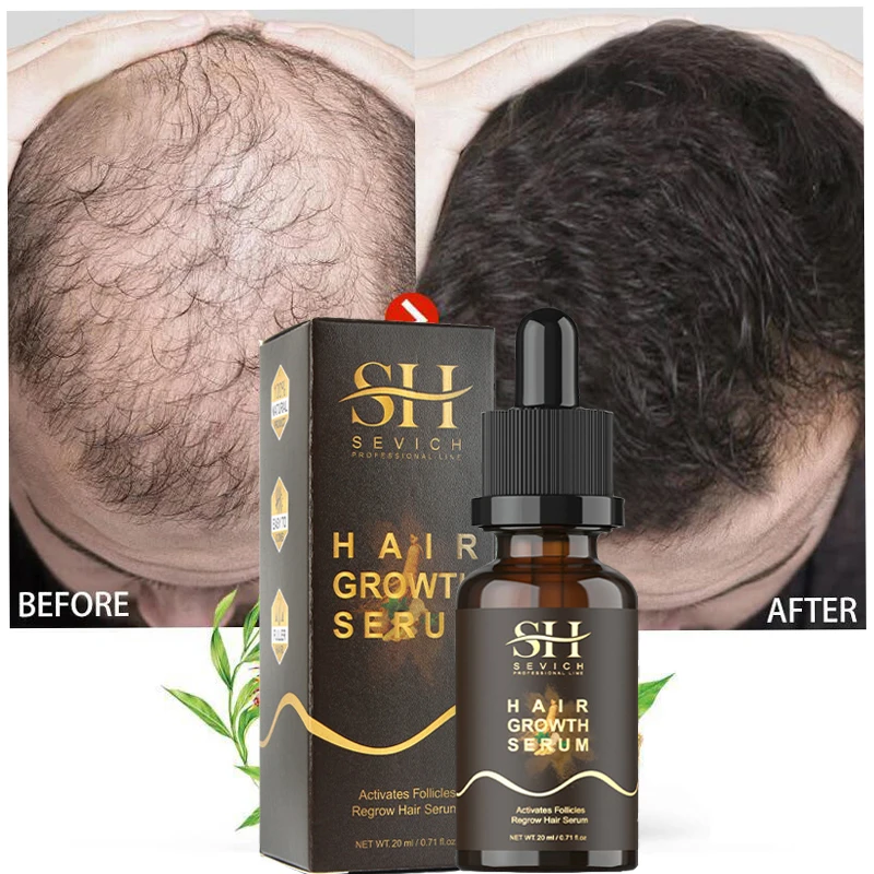 Hair Growth Products Fast Growing Hair Essential Oil Beauty Hair Care Prevent Hair Loss Liquid Scalp Treatment Hair Growth Serum