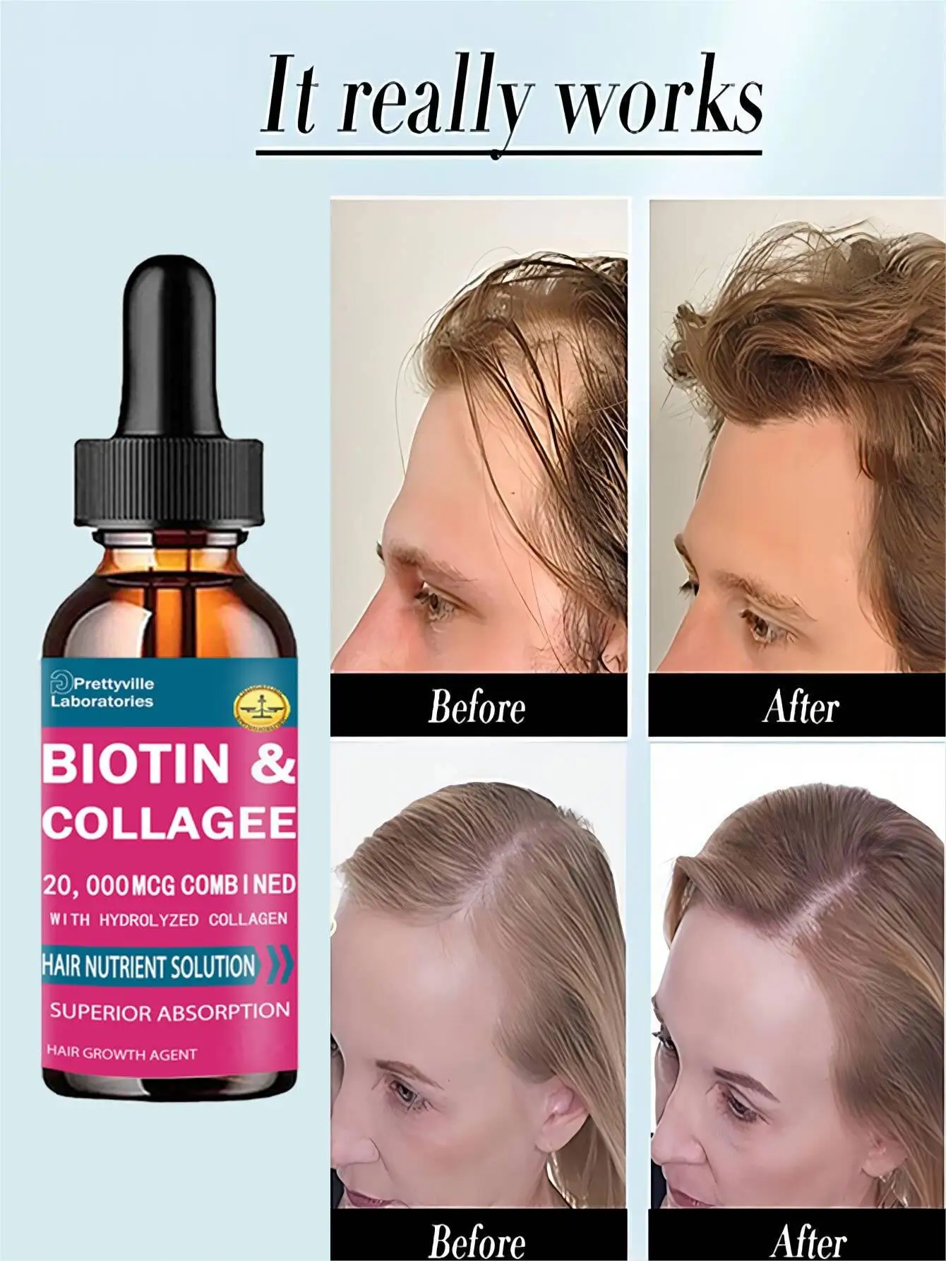 Hairloss Hair Alopecia Hair Treatment for Black Women Growth Oil Head Care Growth Spray