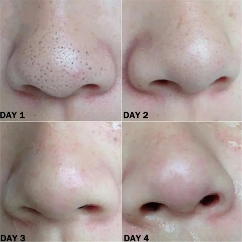 Nariz máscara removedor de cravo limpeza profunda cuidados com a pele tratamento da acne dos poros do psiquiatra unisex máscara nariz preto pontos poros tiras limpas