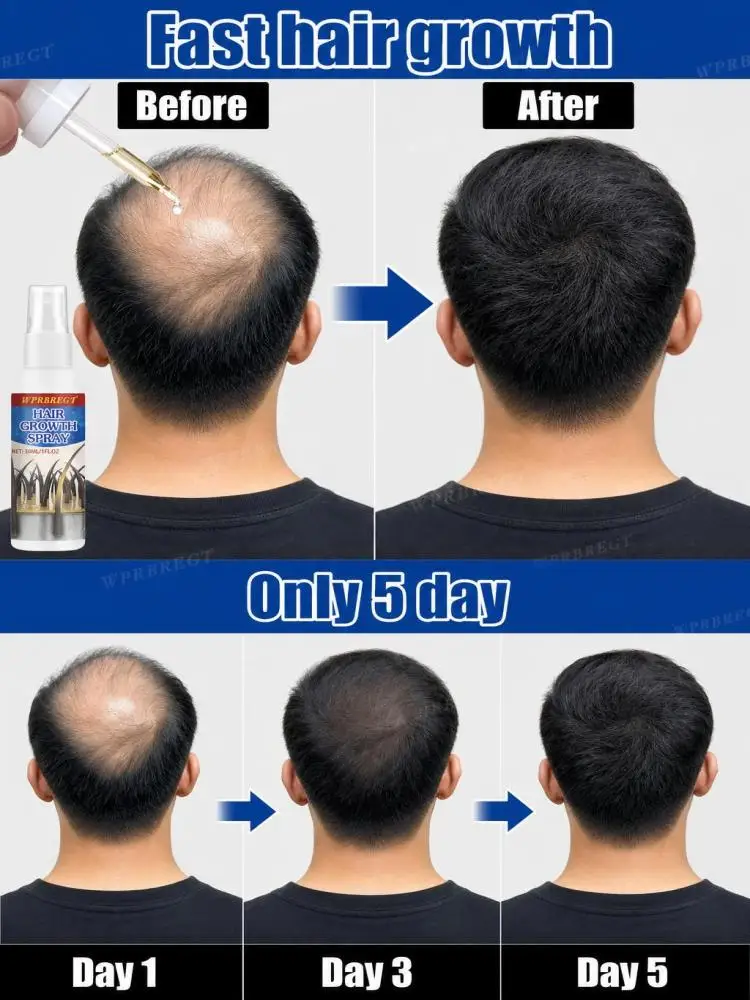 

Breakage Savior! Strengthening Hair Strands Hair Oil, Prevents Breakage and Frizz, Repairs Damaged Hair from Perming and Dyeing