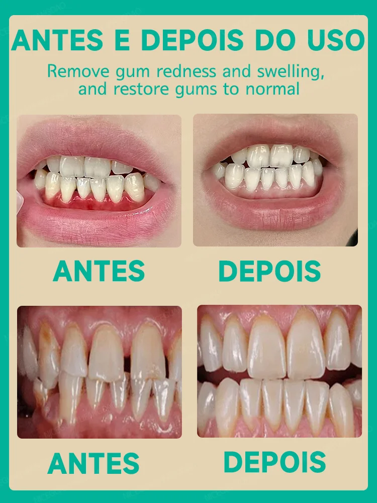 Quickly relieve toothache, repair damaged gums, and have healthy gum drops