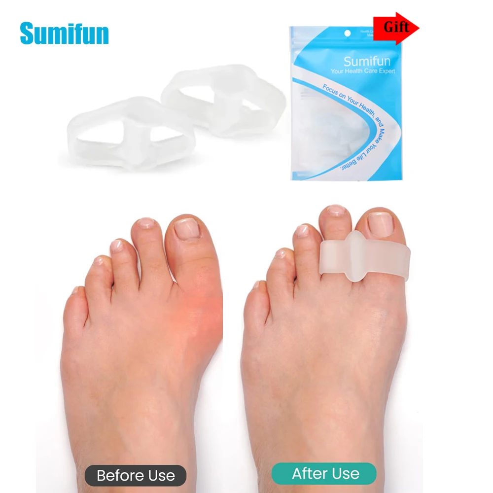 

2/4/6/10Pcs Sumifun White Double Hole Toe Separator Hallux Valgus Toe Overlap Correction Bunion Foot Care Orthopedics Corrector