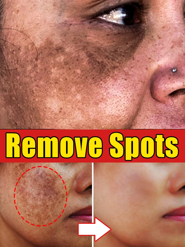 

Effectively dissolve various pigmentation and repair skin tissue