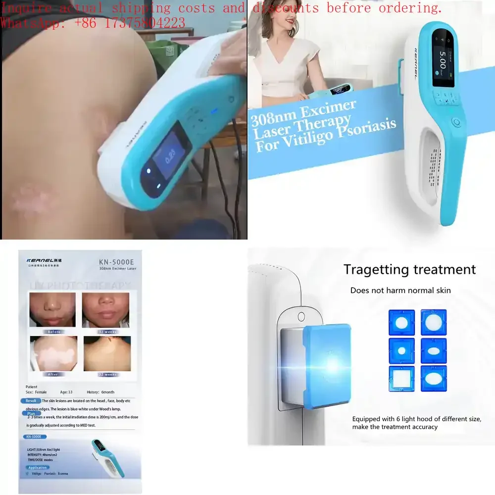 

Hospital Grade Kernel KN 5000E Portable 308nm Excimer : Beat Vitiligo and Alopecia Areata at Home