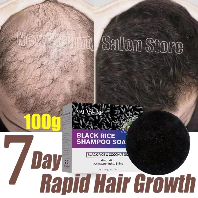 

7 Days Hair Growth Serum Soap For Men Women Regrowth Repair Hair Care Anti Hair Loss Scalp Treatment Products Beauty Health