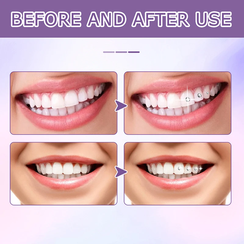 

Dental Tooth Crystal Rhombus Shapes Ornament Diamond Multicolour Shiny Teeth Jewelry Decoration