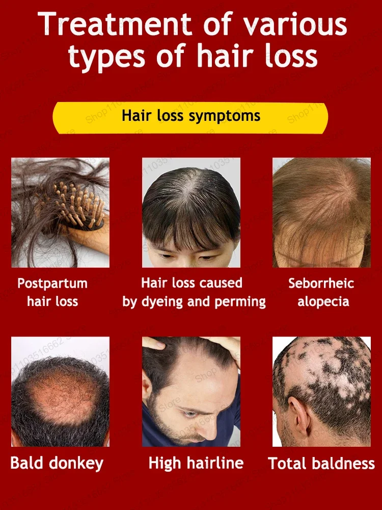 Hot selling hair growth products, fast, help, hair, grow. Fix hair loss, fix baldness.