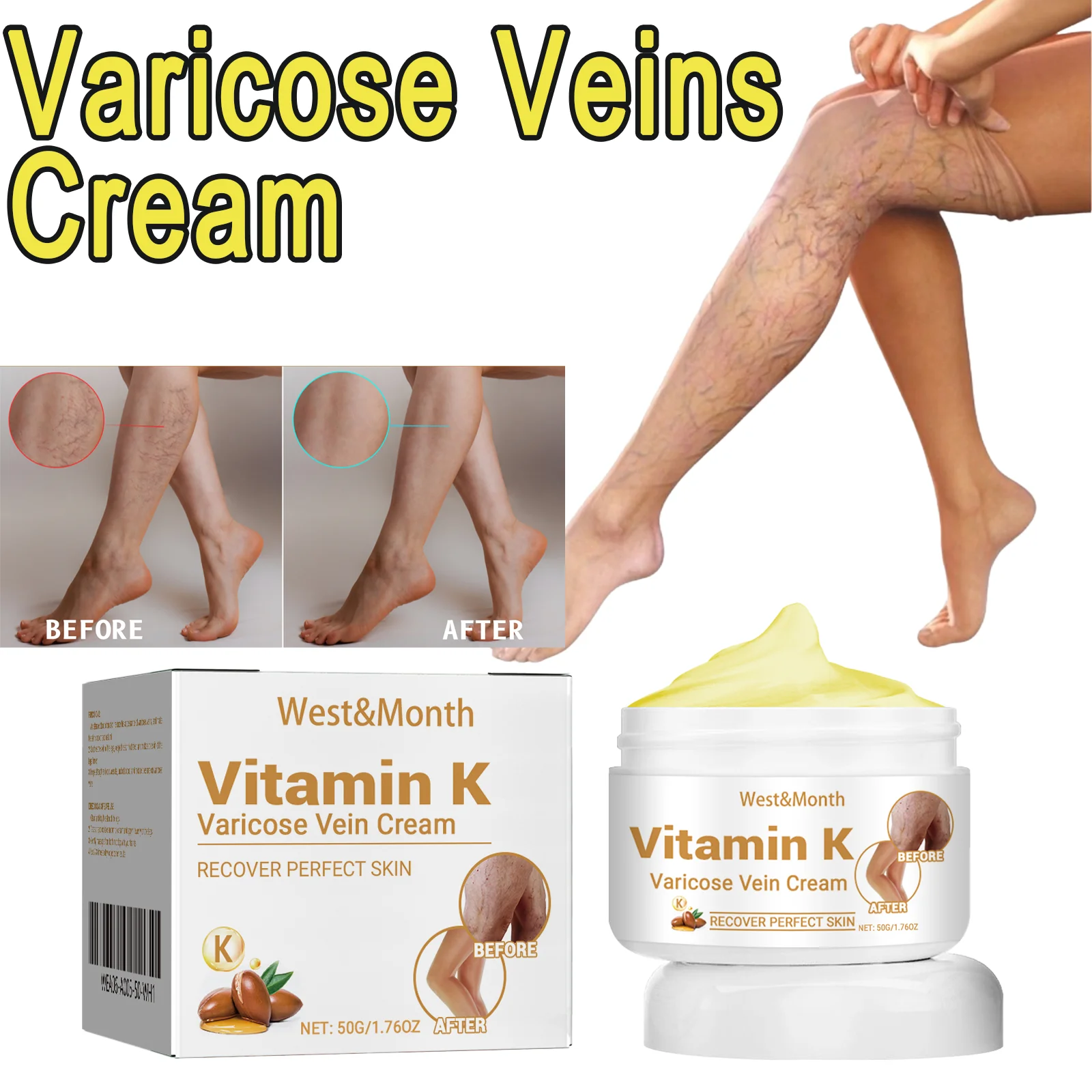 كريم فيتامين K الدوالي يسرع الدورة الدموية ويهدئ بشرة الساقين ويقوي الأوعية الدموية ويحافظ على ترطيبها #1