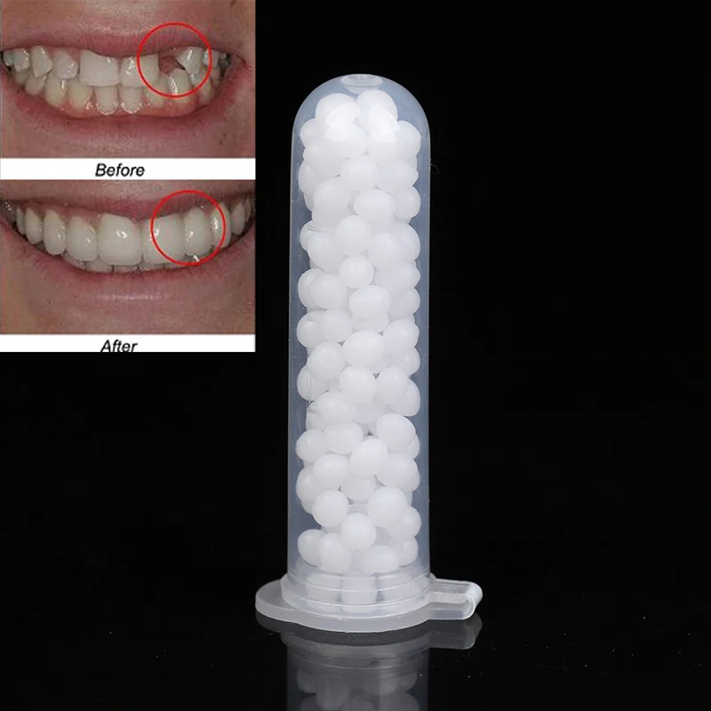 1Box Temporary Resin Tooth Repair Glue Shapeable Teeth Gaps Filling Solid Glue Teeth Repair Falseteeth Glue Dental Supplies