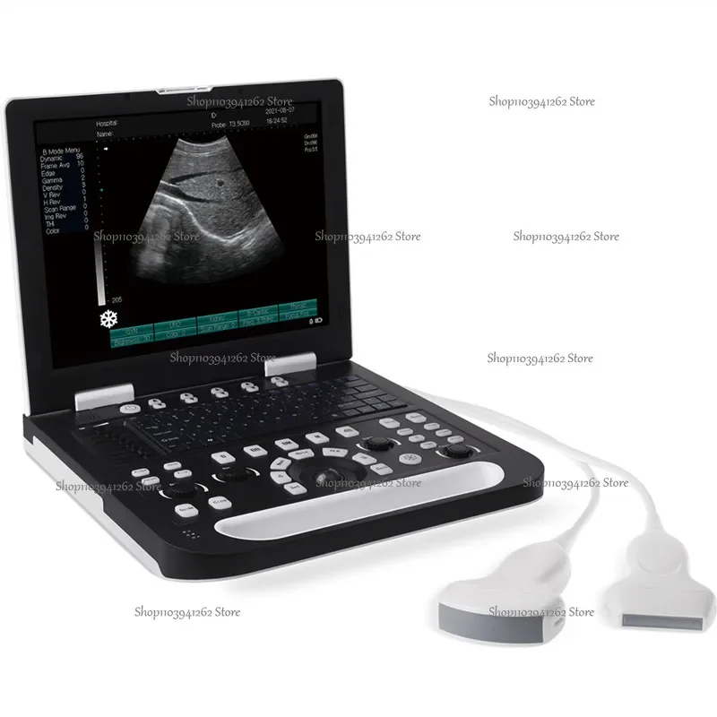 Laptop Ultrasound Machine High Quality Hospital Use Portable All Digital With Dual Probe Interface