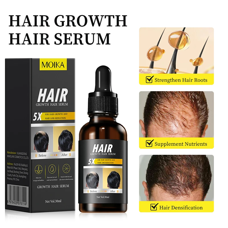 MOIKA 30ml Hair Growth Serum Repair Essential Oil Beauty Hair Care Dense Regrowth Anti Hair Loss Serum Promoting Regeneration