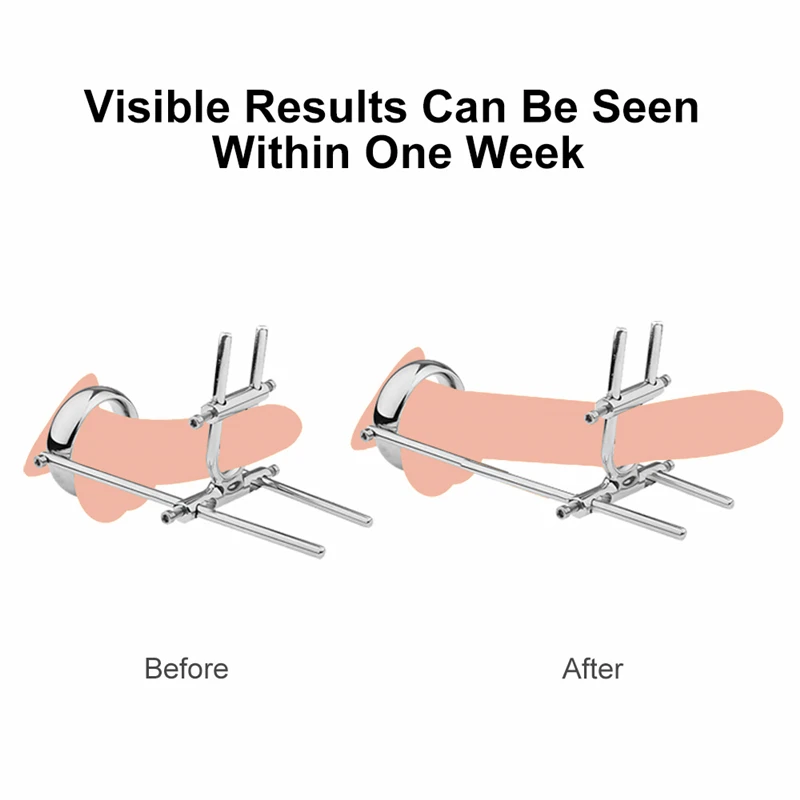 Alisador de alargamento do pénis para o crescimento do pénis, Extensor do pénis, Ampliação do pénis, Cockring Penes Ampliar, Crescimento do pénis