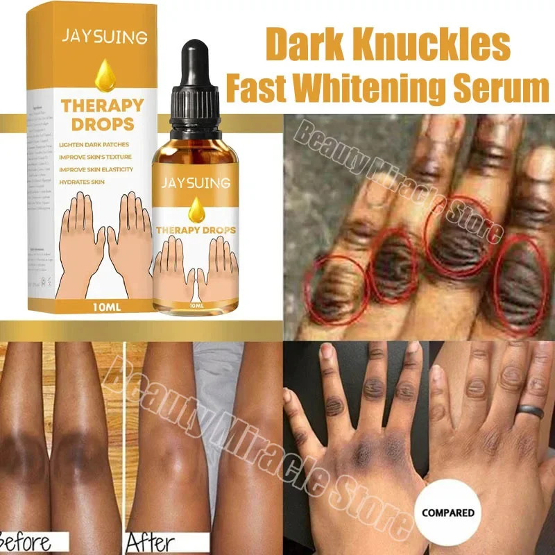 

Dark Knuckles Fast Brighten Serum Elbows Hand Knuckle Brightening Serum Knee Black Skin Quickly Lighten Stains Remover Essence