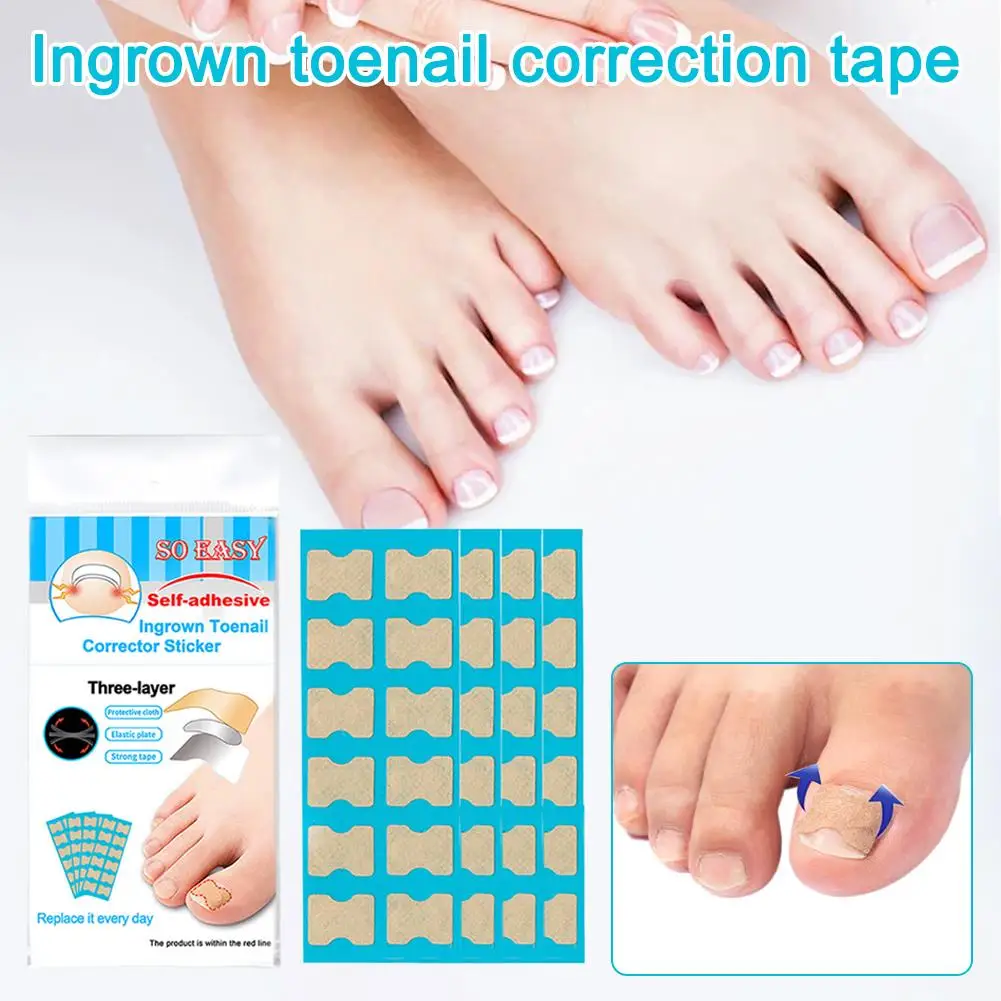 

Nail Fungus Patch Waterproof Nail Repair Patch Ingrown Care Patch Nail Correction Gray Damaged Sticker H5I4