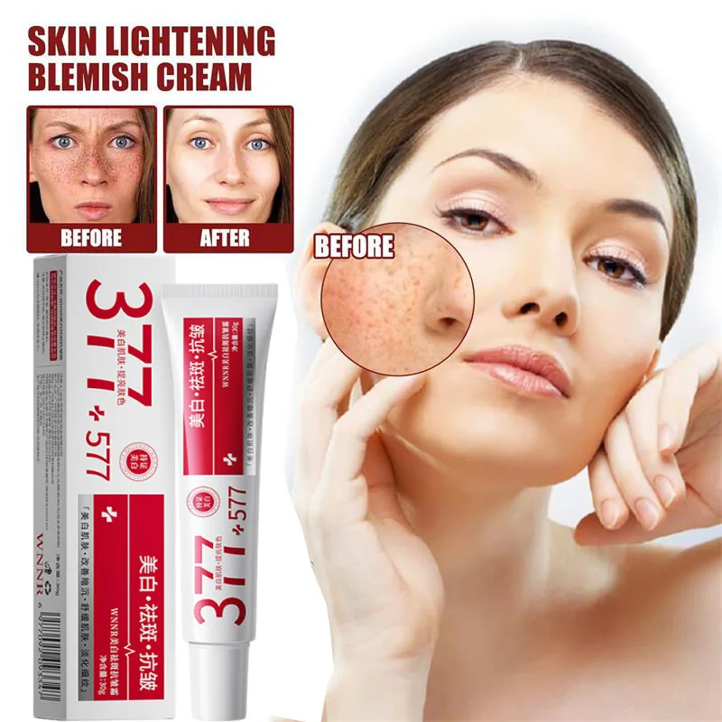 Potente Crema Blanqueadora para Eliminar Manchas, Aclara la Piel Rápidamente, Elimina la Pigmentación de Melanina, Melasma, Manchas Oscuras, Cuidado Facial Coreano