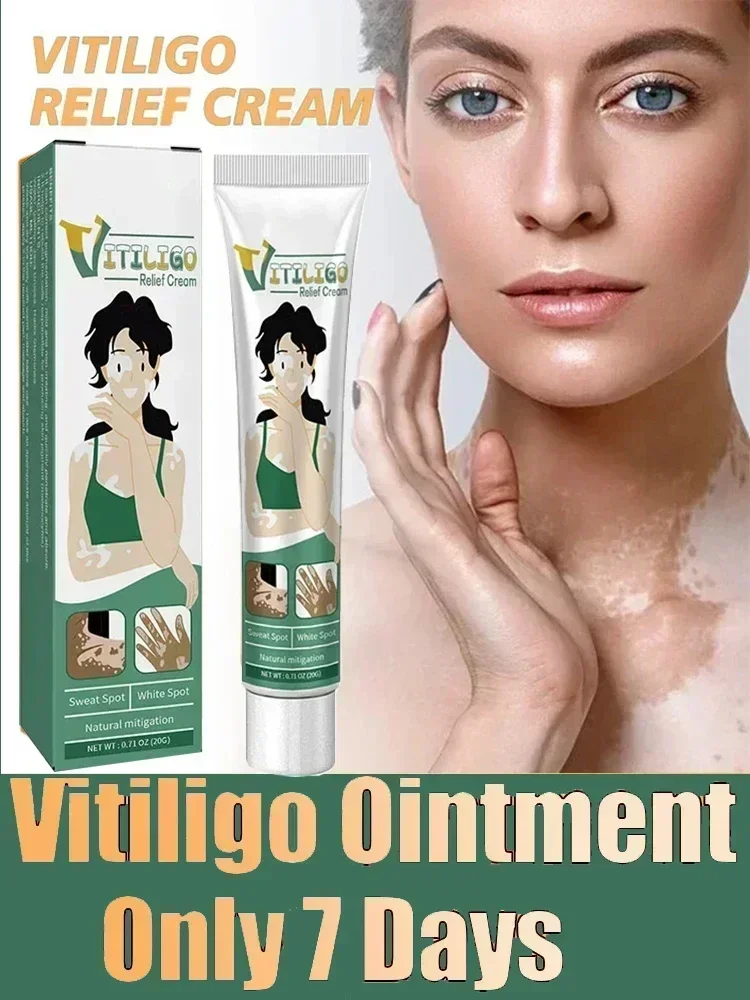 

Лечебный крем для Vitiligo, удаление белых пятен, способствует производству меланина, китайские травы, пятна от пота, уход за кожей Vitiligo