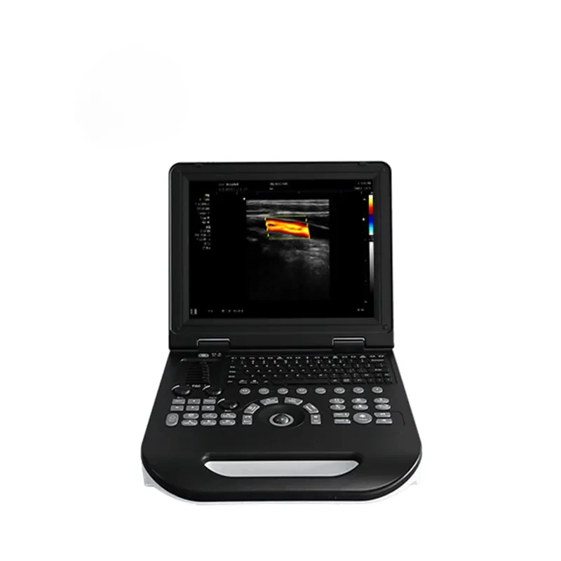 China Manufacturer High Performance B Mode Bladder 3D Portable Convex Ultrasound Scanner