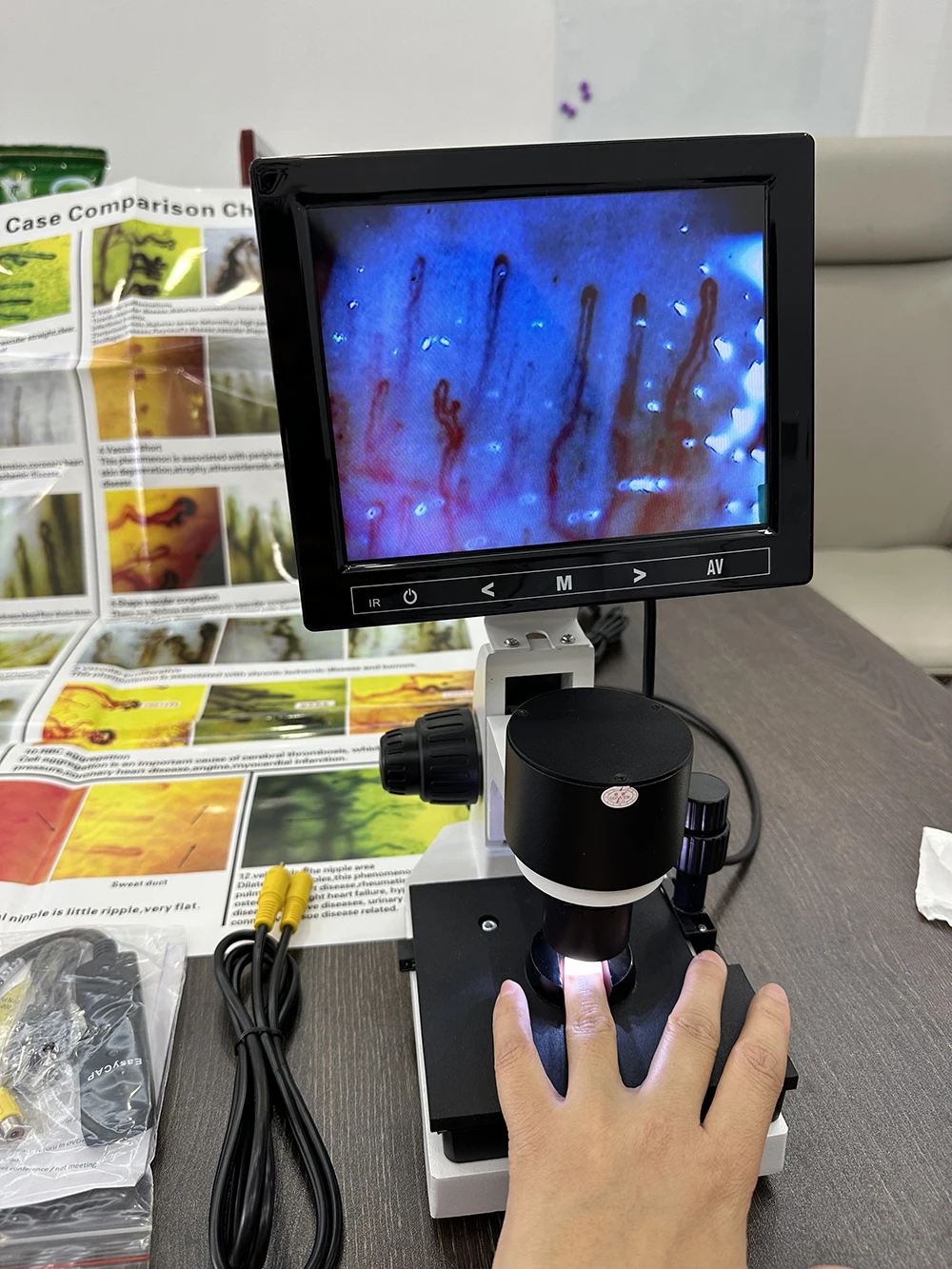 880 Model Microcirculation Microscope Healthcare Beauty Device Fingernail Capillaroscope Detection device 2026