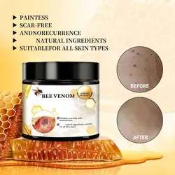 Fast and Gentle Removal Bee Venom Skin Treatment Cream Skin Treatment Bee Venom Bee Venom Cream Fast-Acting