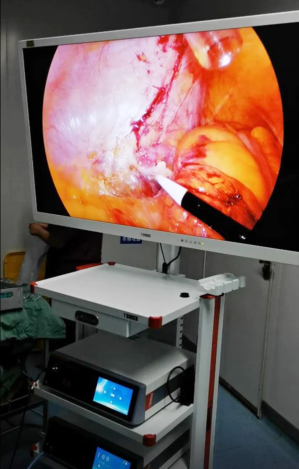 Dispositivi chirurgici laparoscopici telecamera uhd 4k endoscopio