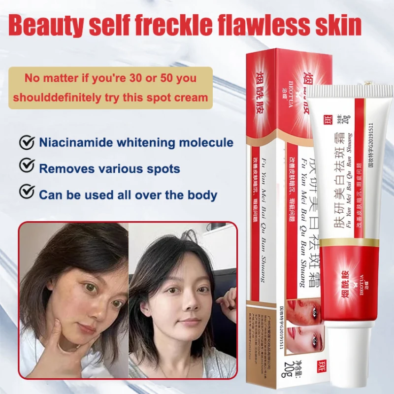 Niacinamide Blemish Cream Bully Cream Skin Cream Research Firming Skin Fading Pigmentation Cream