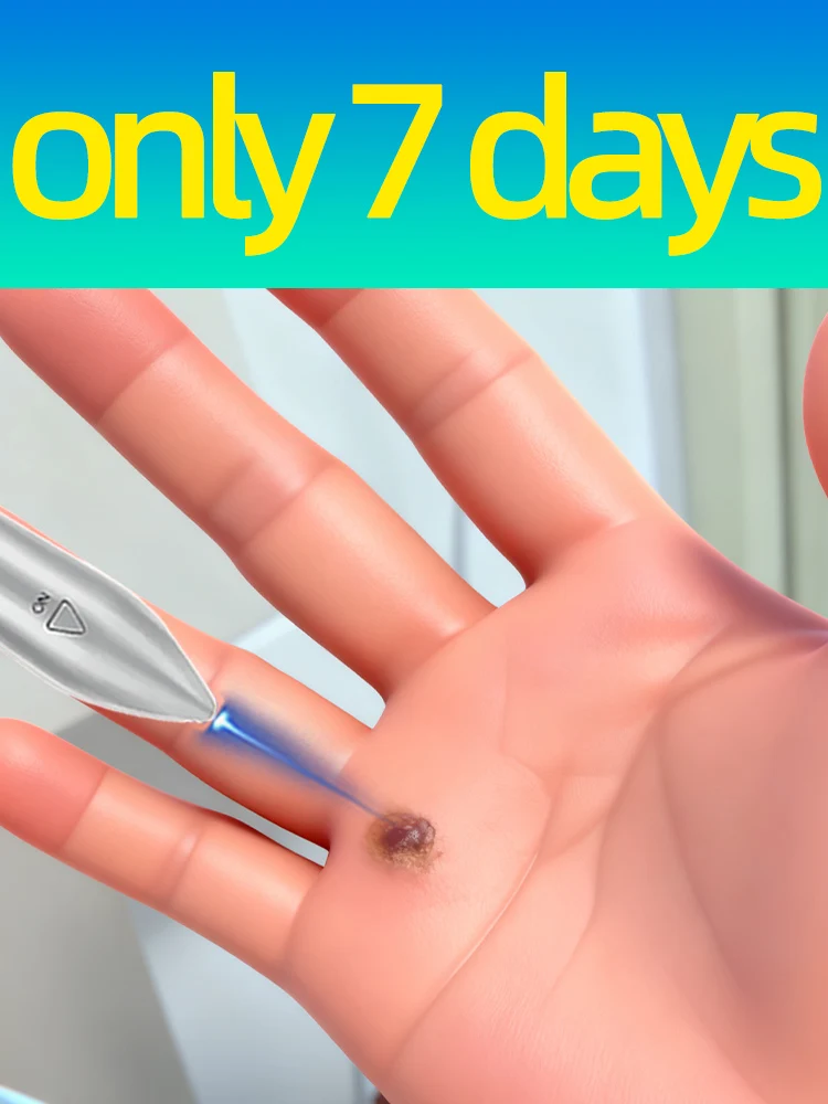 

Gᴇɴᴇʀᴀᴛɪᴏɴ-2 Lᴀsᴇʀ Sᴀʏs Gᴏᴏᴅʙʏᴇ Tᴏ ᴀʟʟ ᴡᴀʀᴛs Iɴ 7 Dᴀʏs.