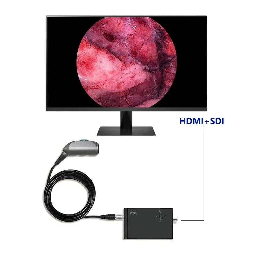 Factory Price Mini 1080P CMOS Portable Medical Endoscope Image Processor for Rigid Endoscopy Camera System