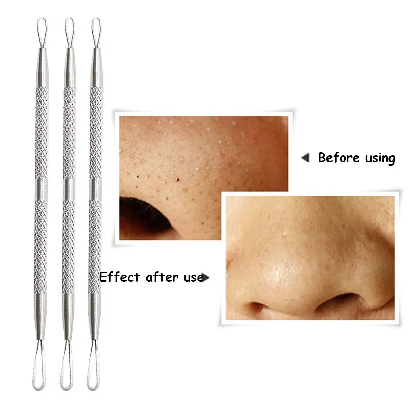 Needles for Squeezing Acne Tools Spoon for Face Cleaning Comedone Extractor Pore Cleaner Black Dot Pimple Blackhead Remover Tool