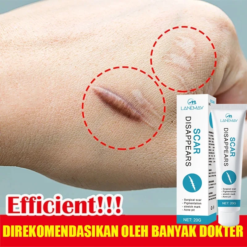 

Растворите шрамы и дайте вам гладкую кожу, инструменты для ухода за шрамами, унисекс, хит продаж в 2025 году.